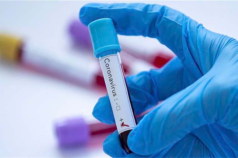 В Черногории ужесточены карантинные меры на 7 дней 2 В Черногории ужесточены карантинные меры на 7 дней - 2