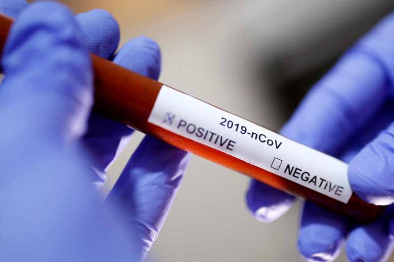 Обновлено: с сегодняшнего дня в Черногории действуют новые карантинные меры 8 Обновлено: с сегодняшнего дня в Черногории действуют новые карантинные меры - 8