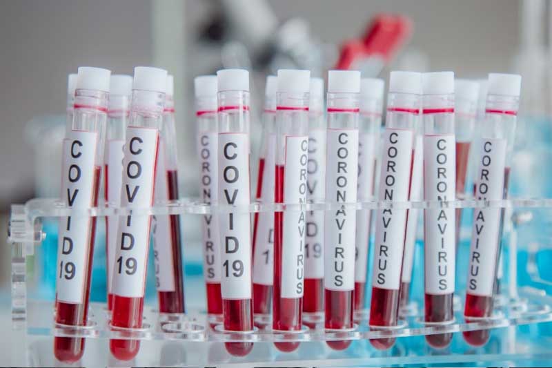 С пятницы в Подгорице, Цетине, Будве и Улцине будут закрыты кафе и рестораны 10 С пятницы в Подгорице, Цетине, Будве и Улцине будут закрыты кафе и рестораны - 10